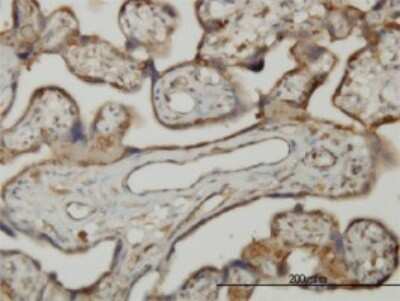 Immunohistochemistry-Paraffin: SLK Antibody (3E9) [H00009748-M01]