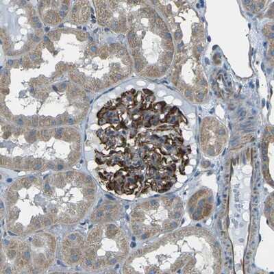 Immunohistochemistry-Paraffin: SLK Antibody [NBP1-83024]