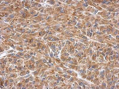 Immunohistochemistry-Paraffin: SLK Antibody [NBP2-20401]