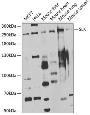 Western Blot: SLK AntibodyBSA Free [NBP3-04553]