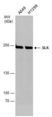 Western Blot: SLK Antibody [NBP3-13025]