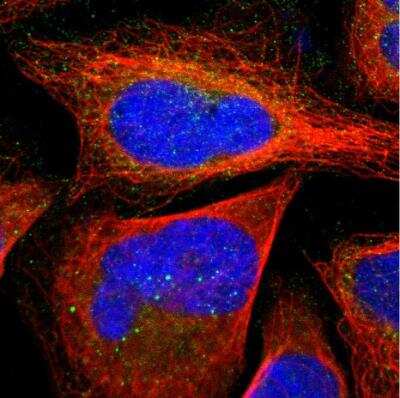 Immunocytochemistry/ Immunofluorescence: SLMAP Antibody [NBP1-81398]