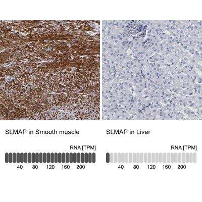 Immunohistochemistry-Paraffin: SLMAP Antibody [NBP1-81397]