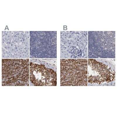 Immunohistochemistry-Paraffin: SLMAP Antibody [NBP1-81397]