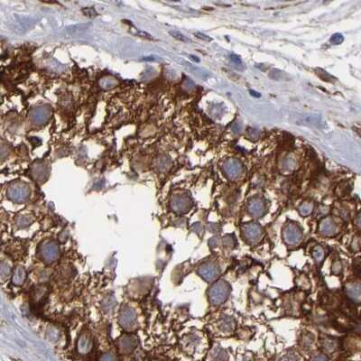 Immunohistochemistry-Paraffin: SLMAP Antibody [NBP1-81397]