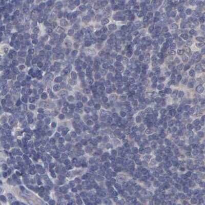 Immunohistochemistry-Paraffin: SLMAP Antibody [NBP1-81397]