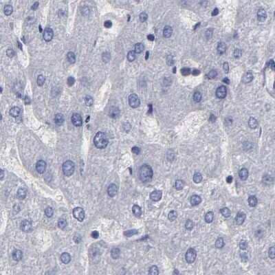 Immunohistochemistry-Paraffin: SLMAP Antibody [NBP1-81397]