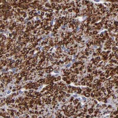 Immunohistochemistry-Paraffin: SLMAP Antibody [NBP1-81397]