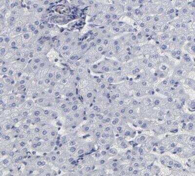 Immunohistochemistry-Paraffin: SLMAP Antibody [NBP1-81397]