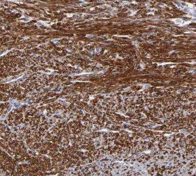 Immunohistochemistry-Paraffin: SLMAP Antibody [NBP1-81397]