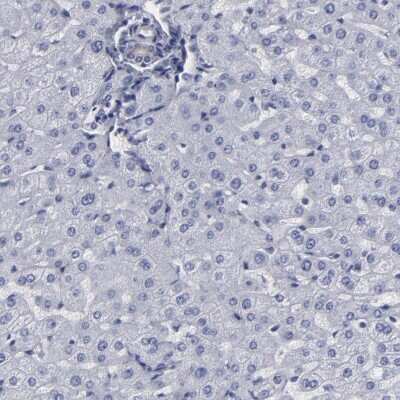 Immunohistochemistry-Paraffin: SLMAP Antibody [NBP1-81398]