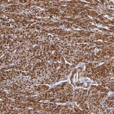 Immunohistochemistry-Paraffin: SLMAP Antibody [NBP1-81398]