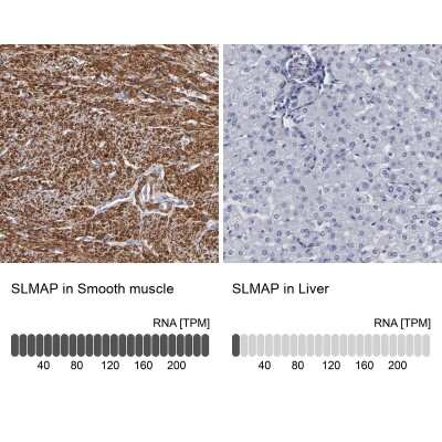 Immunohistochemistry-Paraffin: SLMAP Antibody [NBP1-81398]