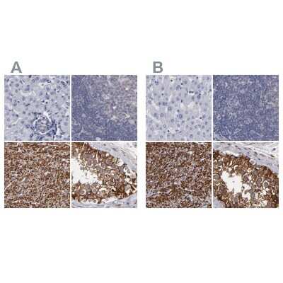 Immunohistochemistry-Paraffin: SLMAP Antibody [NBP1-81398]