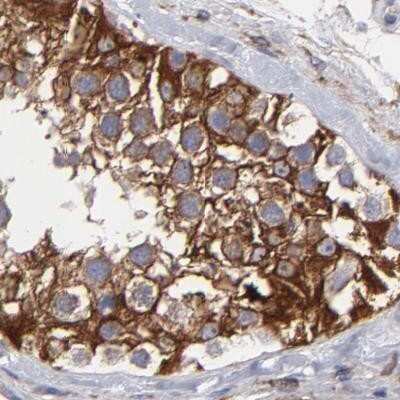 Immunohistochemistry-Paraffin: SLMAP Antibody [NBP1-81398]