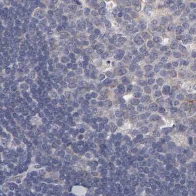 Immunohistochemistry-Paraffin: SLMAP Antibody [NBP1-81398]