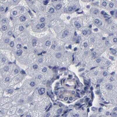 Immunohistochemistry-Paraffin: SLMAP Antibody [NBP1-81398]