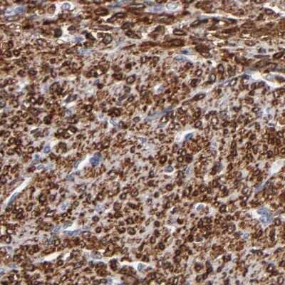 Immunohistochemistry-Paraffin: SLMAP Antibody [NBP1-81398]