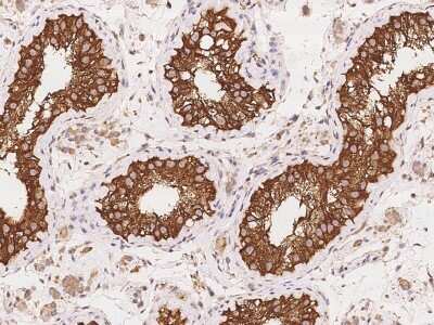 Immunohistochemistry-Paraffin: SLMAP Antibody [NBP3-06131]