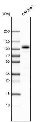Western Blot: SLMAP Antibody [NBP1-81397]