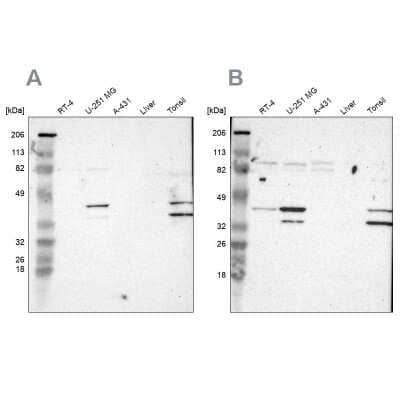 Western Blot: SLMAP Antibody [NBP1-81398]