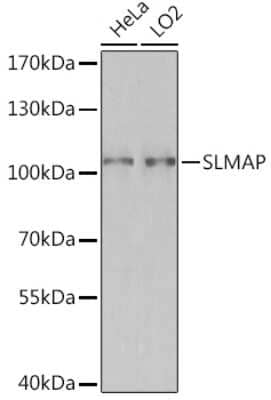 Western Blot: SLMAP AntibodyAzide and BSA Free [NBP3-15511]