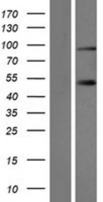 Western Blot: SLMAP Overexpression Lysate [NBP2-07525]