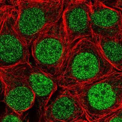 Immunocytochemistry/ Immunofluorescence: SLMO2 Antibody [NBP2-33497]