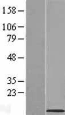 Western Blot: SLN Overexpression Lysate [NBL1-16214]