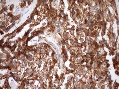 Immunohistochemistry: SLP-2 Antibody (OTI1F5) [NBP2-45464]