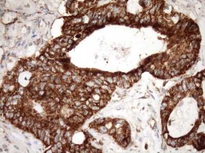 Immunohistochemistry: SLP-2 Antibody (OTI1F5) [NBP2-45464]