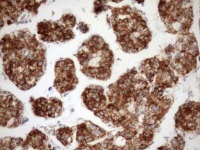 Immunohistochemistry: SLP-2 Antibody (OTI1F5) [NBP2-45464]