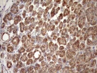 Immunohistochemistry: SLP-2 Antibody (OTI1F5) [NBP2-45464]