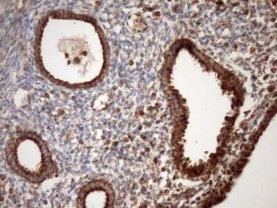 Immunohistochemistry: SLP-2 Antibody (OTI1F5) [NBP2-45464]
