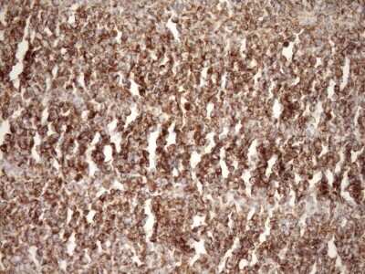 Immunohistochemistry: SLP-2 Antibody (OTI1F5) [NBP2-45464]