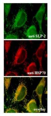 Immunocytochemistry/ Immunofluorescence: SLP-2 Antibody [NBP2-80112]