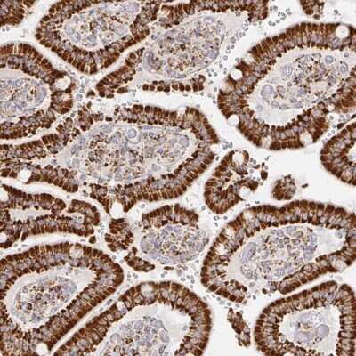 Immunohistochemistry-Paraffin: SLP-2 Antibody [NBP2-38943]