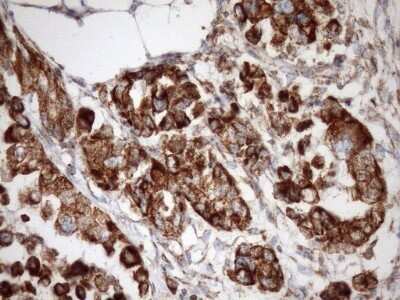 Immunohistochemistry: SLP-2 Antibody (OTI1F5) - Azide and BSA Free [NBP2-74227]