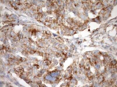 Immunohistochemistry: SLP-2 Antibody (OTI1F5) - Azide and BSA Free [NBP2-74227]