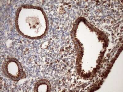 Immunohistochemistry: SLP-2 Antibody (OTI1F5) - Azide and BSA Free [NBP2-74227]
