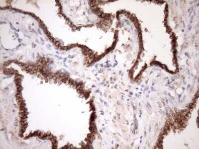 Immunohistochemistry: SLP-2 Antibody (OTI1F5) - Azide and BSA Free [NBP2-74227]
