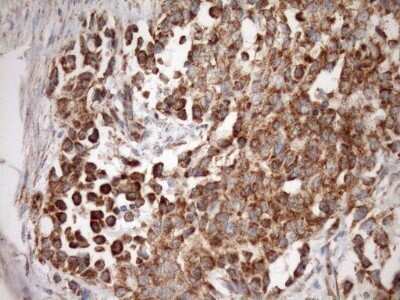 Immunohistochemistry: SLP-2 Antibody (OTI1F5) - Azide and BSA Free [NBP2-74227]