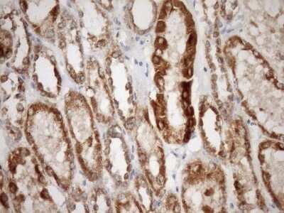 Immunohistochemistry: SLP-2 Antibody (OTI1F5) - Azide and BSA Free [NBP2-74227]