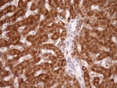 Immunohistochemistry: SLP-2 Antibody (OTI1F5) - Azide and BSA Free [NBP2-74227]