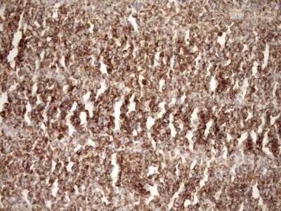 Immunohistochemistry: SLP-2 Antibody (OTI1F5) - Azide and BSA Free [NBP2-74227]