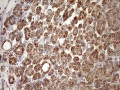 Immunohistochemistry: SLP-2 Antibody (OTI1F5) - Azide and BSA Free [NBP2-74227]