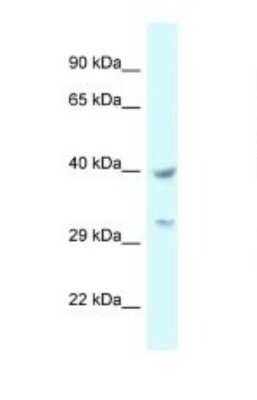 Western Blot: SLP-2 Antibody [NBP1-79903]