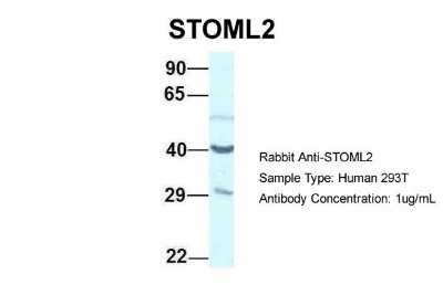Western Blot: SLP-2 Antibody [NBP1-79903]