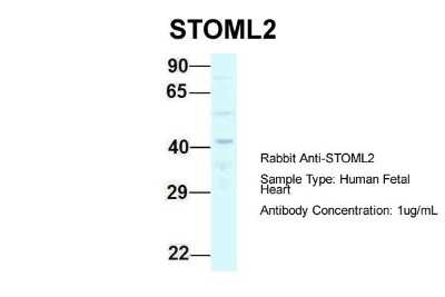 Western Blot: SLP-2 Antibody [NBP1-79903]