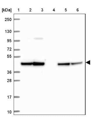 Western Blot: SLP-2 Antibody [NBP2-38943]